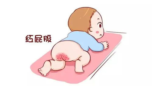 什么牌子尿不湿比较好用,拒绝微商东西?