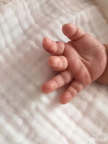 三岁小孩被自家四个月大的小狗咬破手指出血要打针吗?