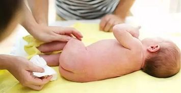 宝妈们,宝宝的纸尿裤牌子经常换,这样对宝宝好不好?